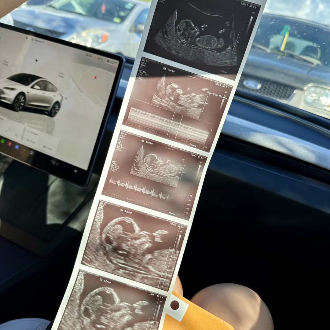Photo shared by Jelena for their Babylist baby registry.