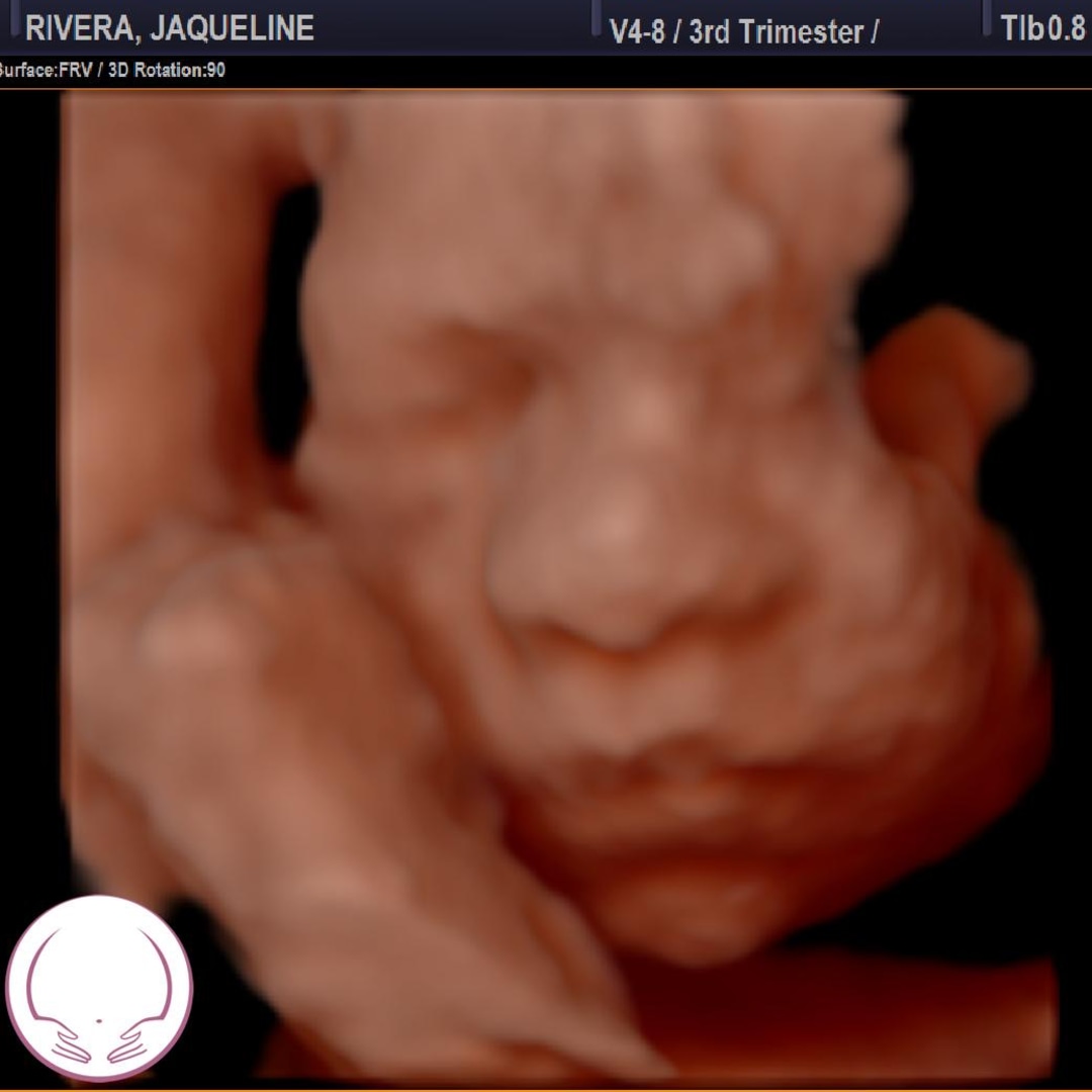 Photo shared by Jaqueline for their Babylist baby registry.