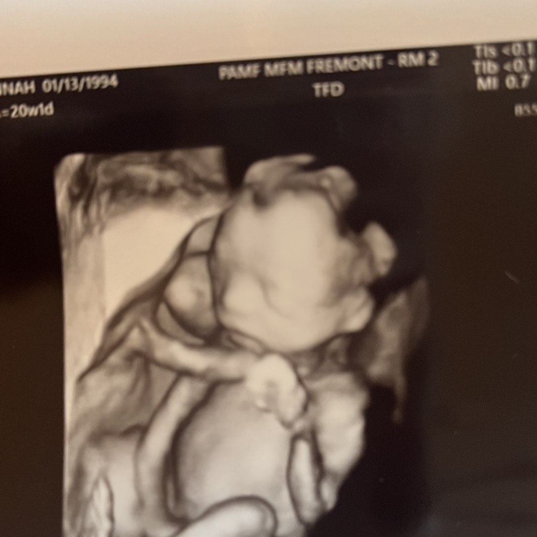 Photo shared by Hannah for their Babylist baby registry.