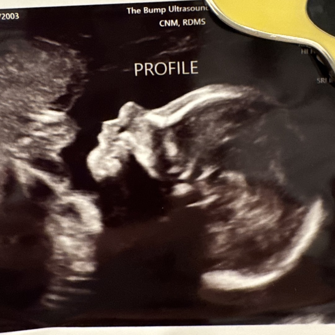 Photo shared by Alivia for their Babylist baby registry.