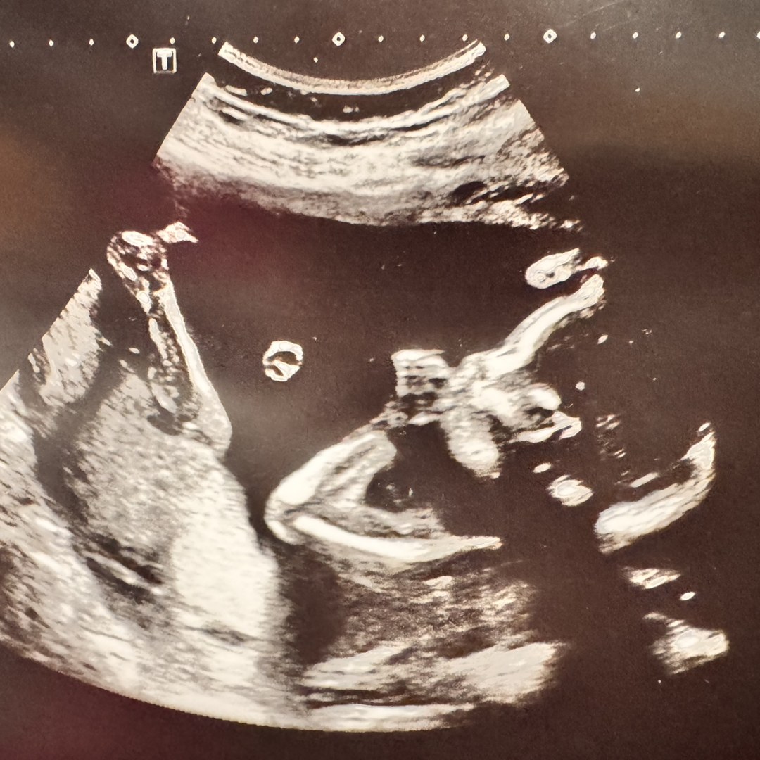 Photo shared by Treiquella for their Babylist baby registry.