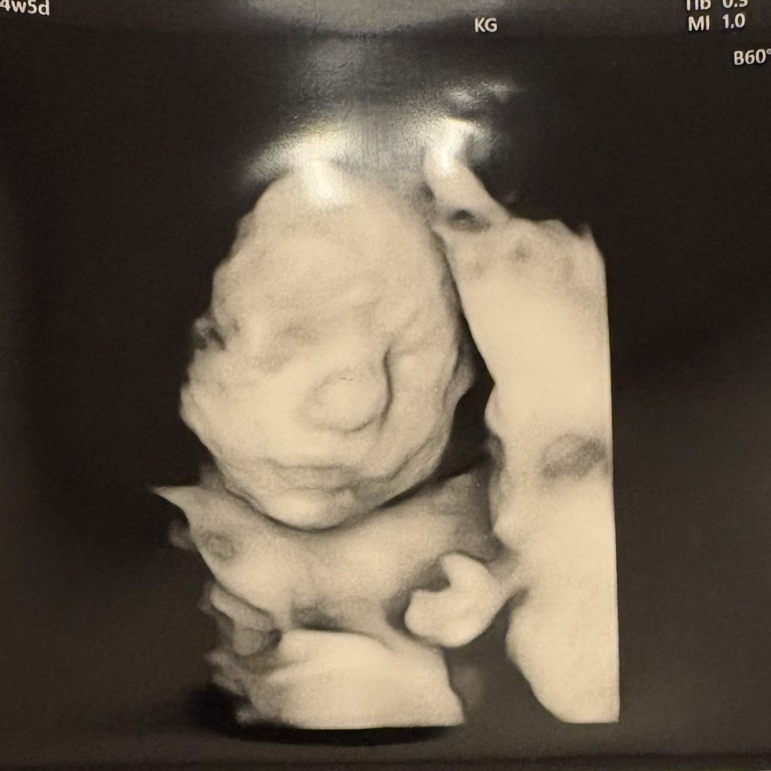 Photo shared by Brinley for their Babylist baby registry.