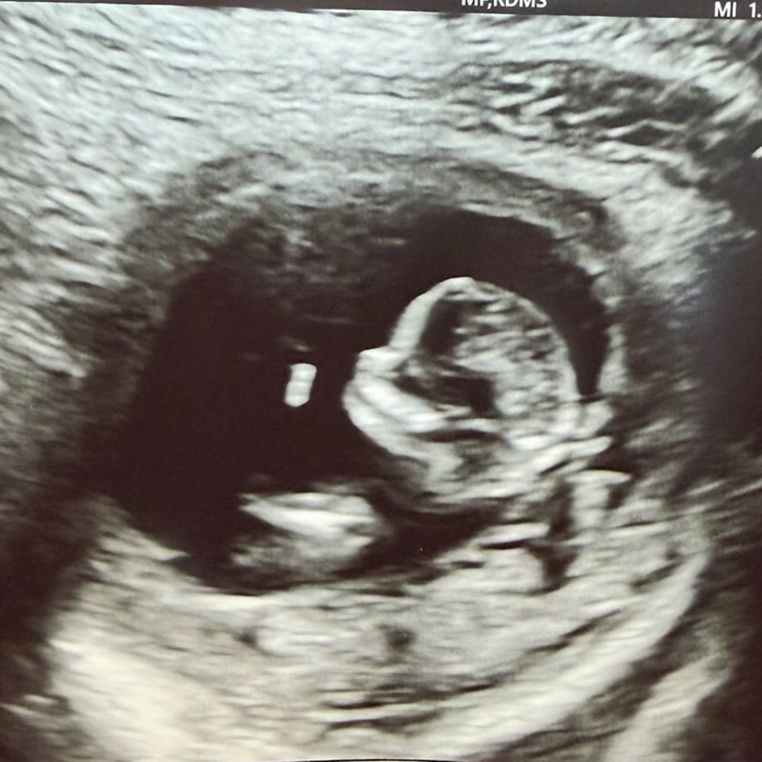Photo shared by Hannah for their Babylist baby registry.