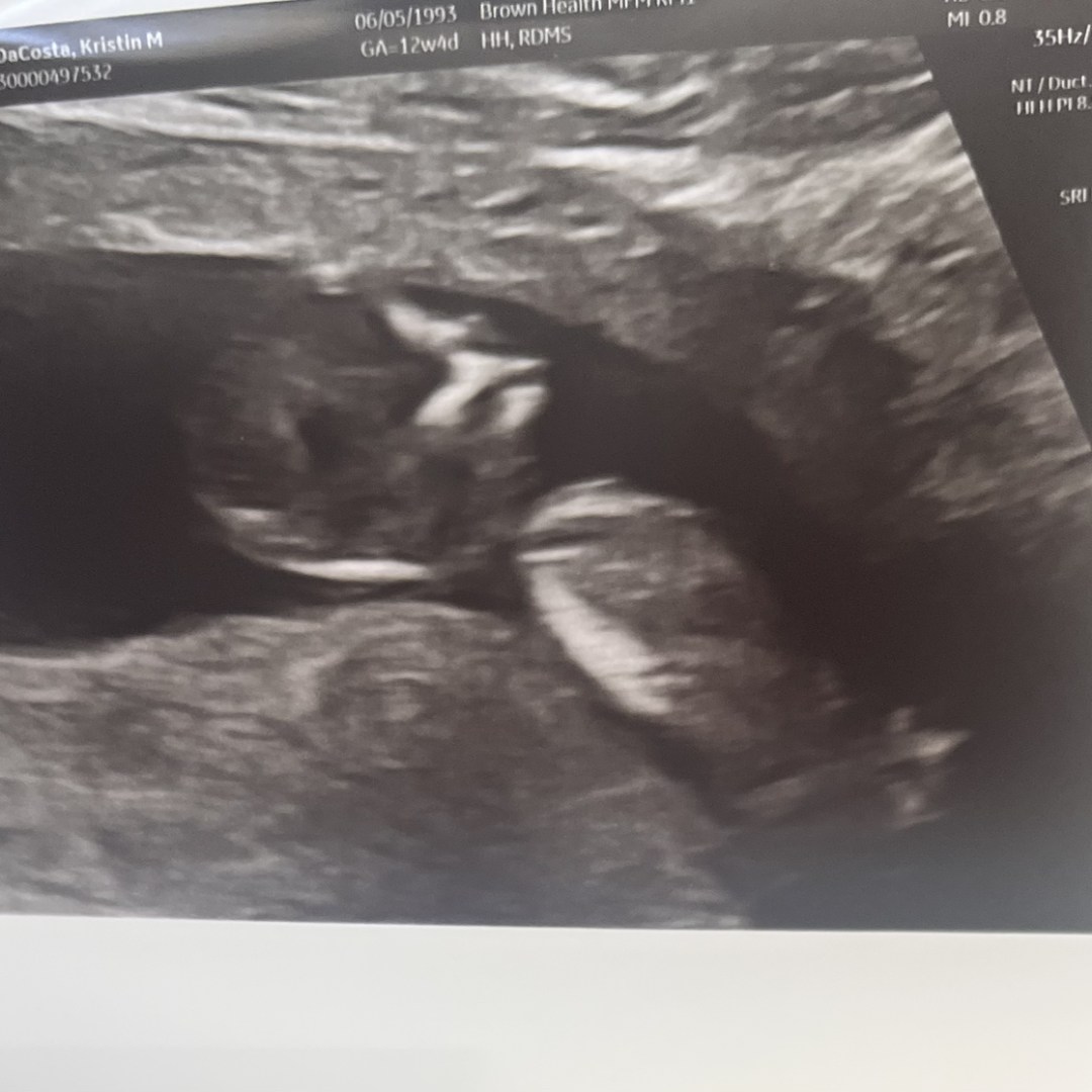 Photo shared by Kristin for their Babylist baby registry.