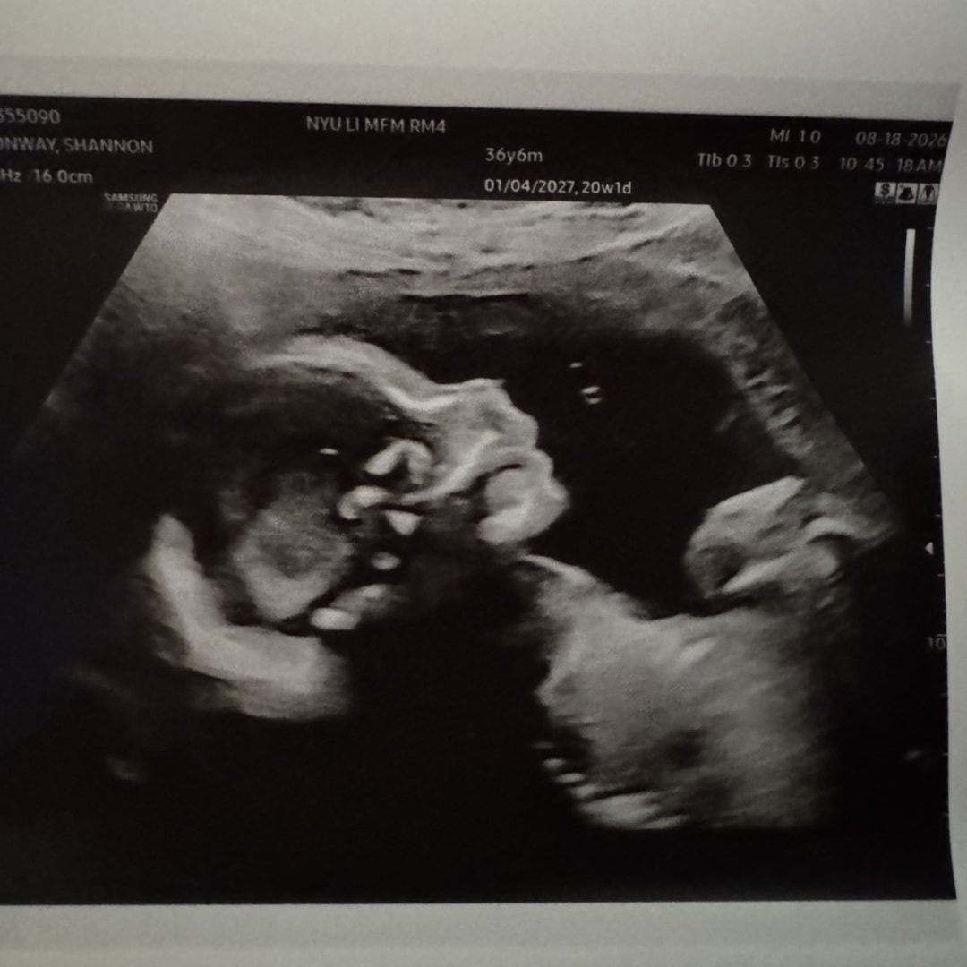 Photo shared by Shannon for their Babylist baby registry.