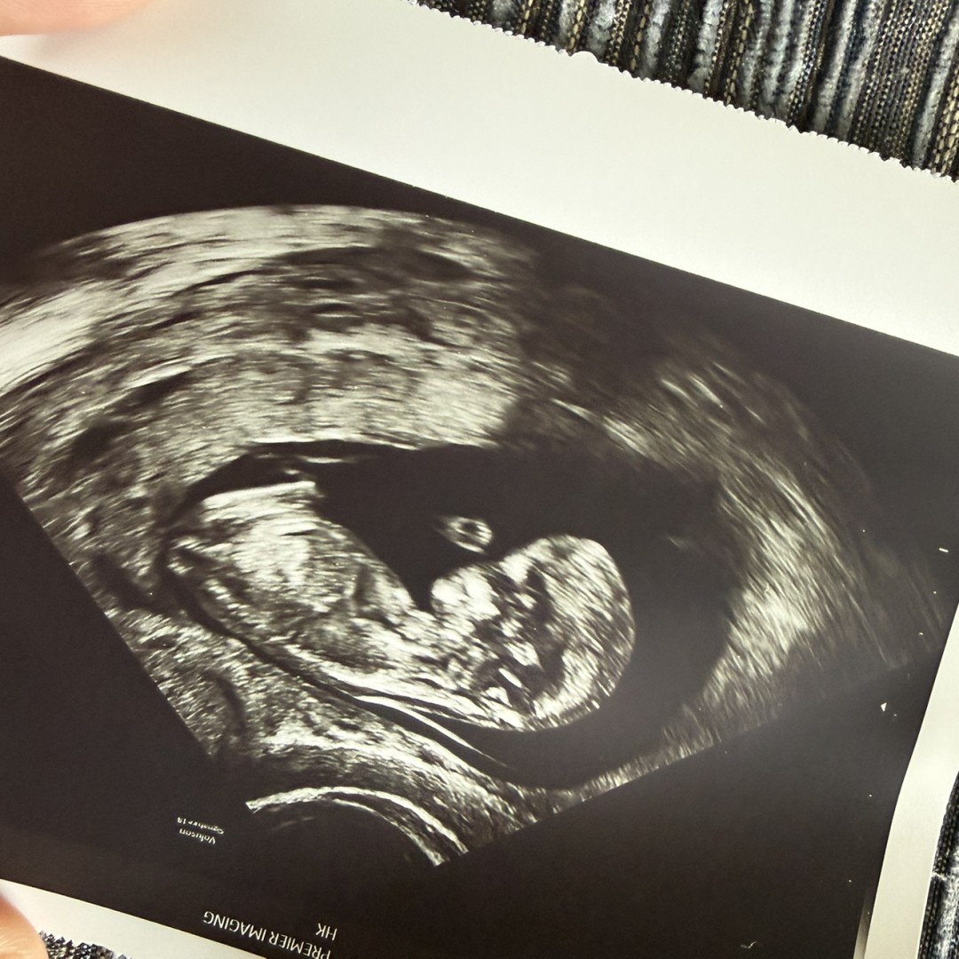 Photo shared by Giselle mae for their Babylist baby registry.