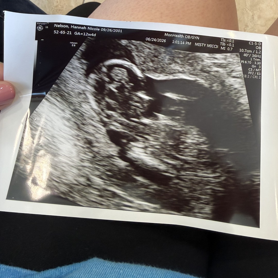 Photo shared by Hannah for their Babylist baby registry.