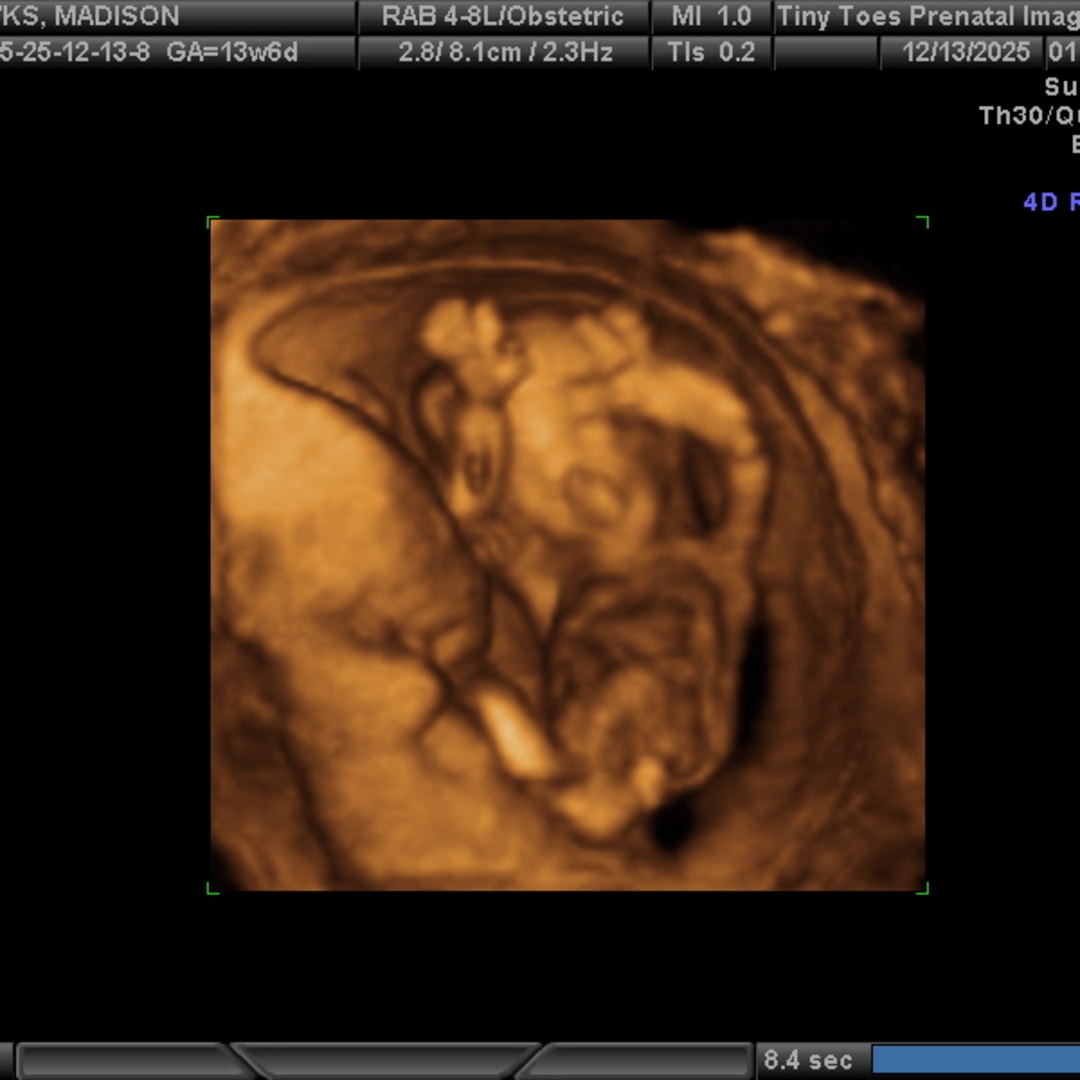 Photo shared by Madison for their Babylist baby registry.