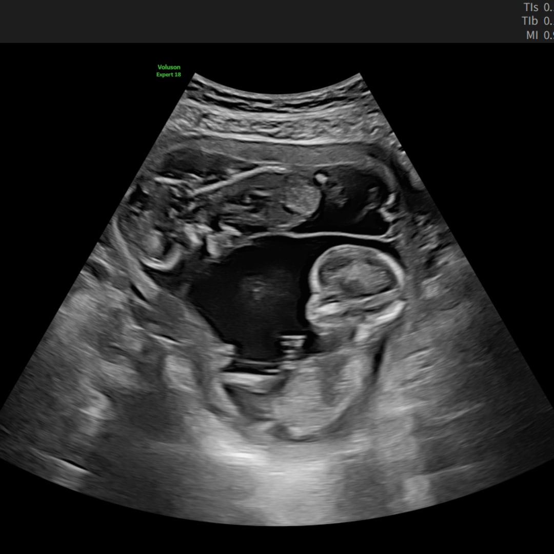 Photo shared by Emma for their Babylist baby registry.