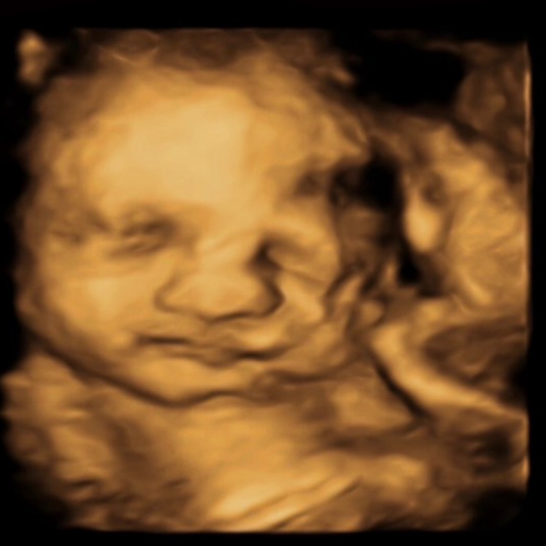 Photo shared by Marjorie for their Babylist baby registry.