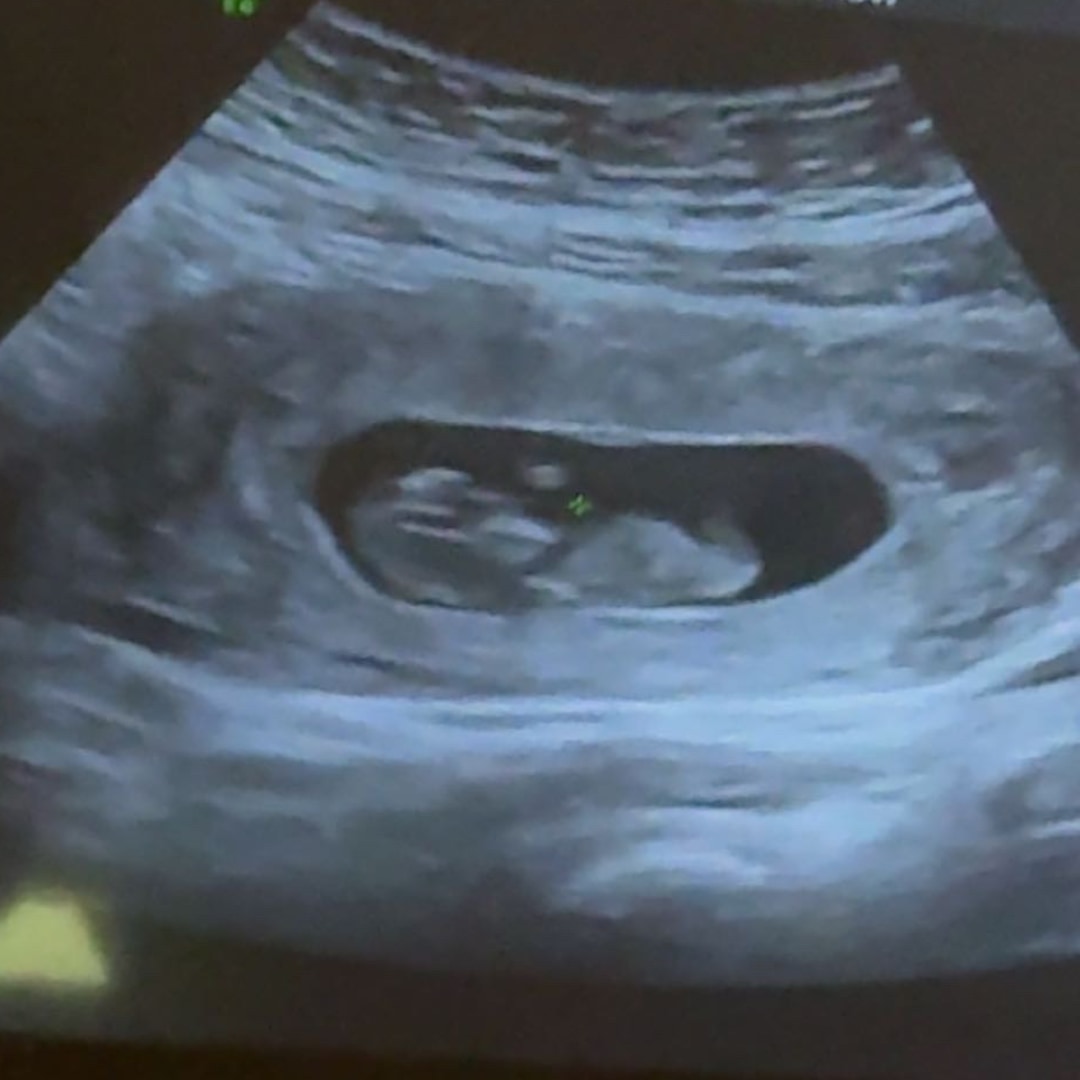 Photo shared by Joleena for their Babylist baby registry.