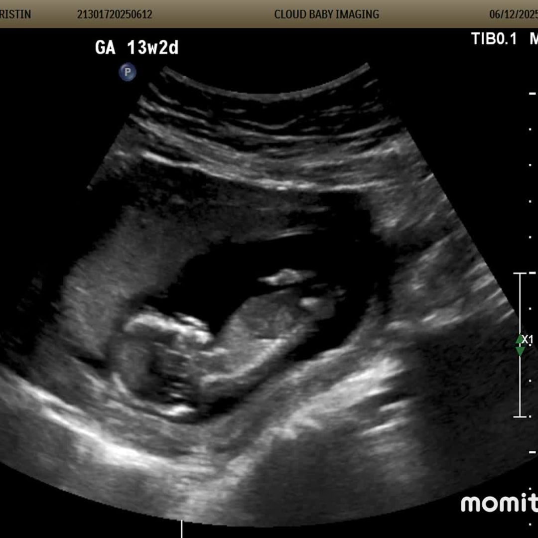 Photo shared by Kristin for their Babylist baby registry.