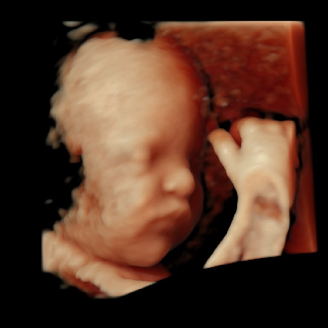 Photo shared by Mikala for their Babylist baby registry.