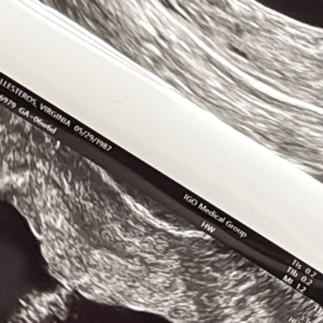 Photo shared by Vicky for their Babylist baby registry.