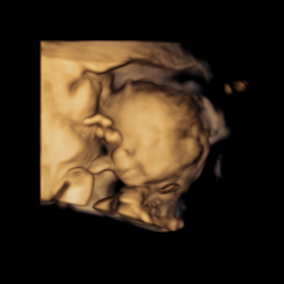Photo shared by Karen for their Babylist baby registry.