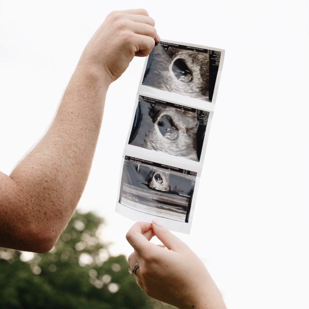 Photo shared by Maggie for their Babylist baby registry.
