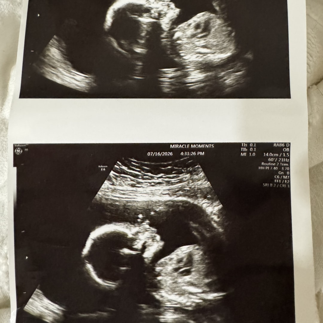 Photo shared by Emily for their Babylist baby registry.