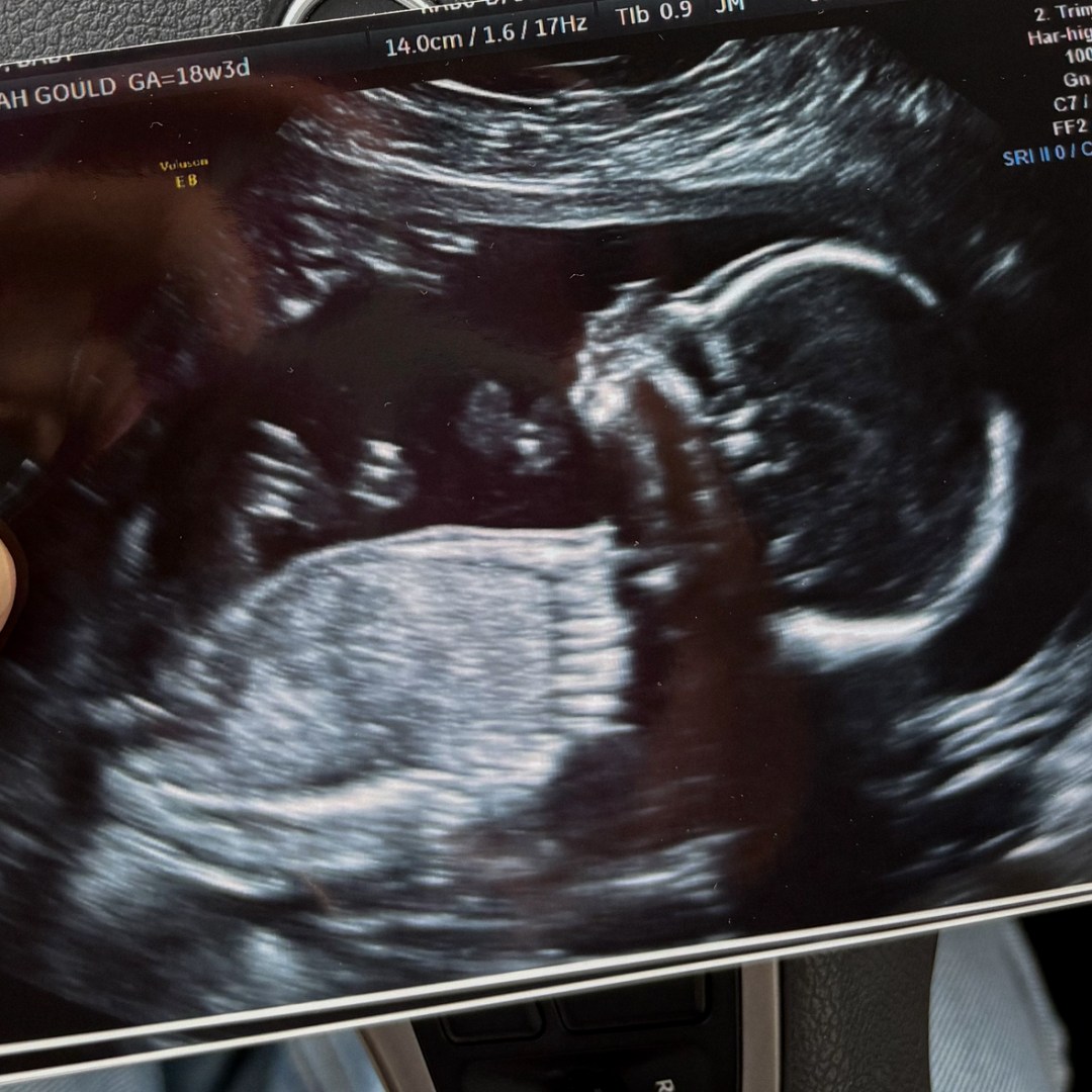 Photo shared by Hannah for their Babylist baby registry.