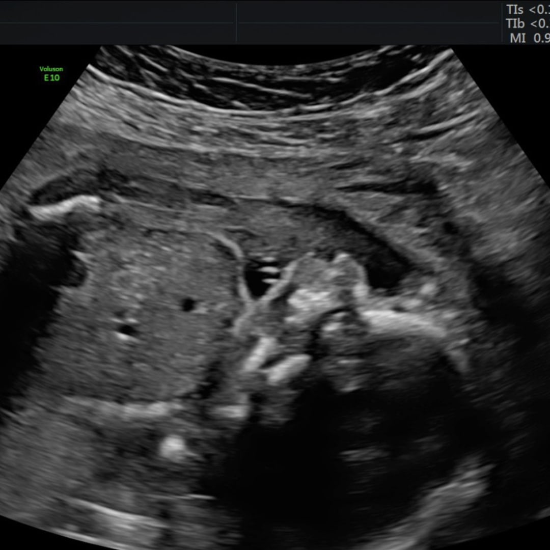 Photo shared by Nevaeh for their Babylist baby registry.