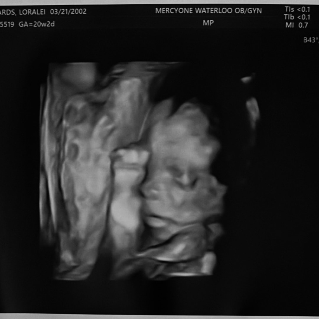 Photo shared by Loralei for their Babylist baby registry.