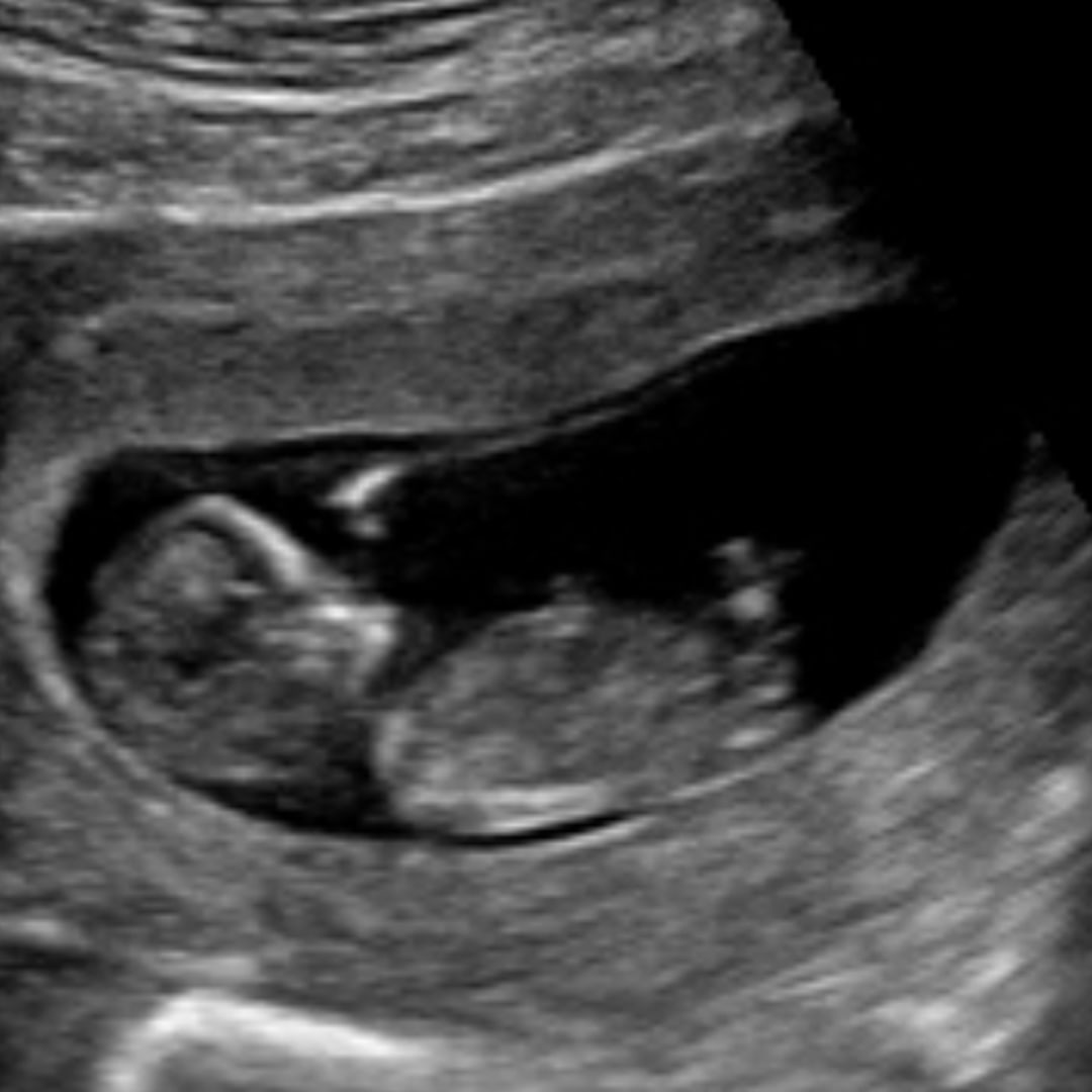 Photo shared by Kim for their Babylist baby registry.