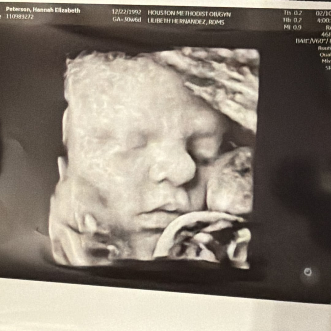 Photo shared by Hannah for their Babylist baby registry.