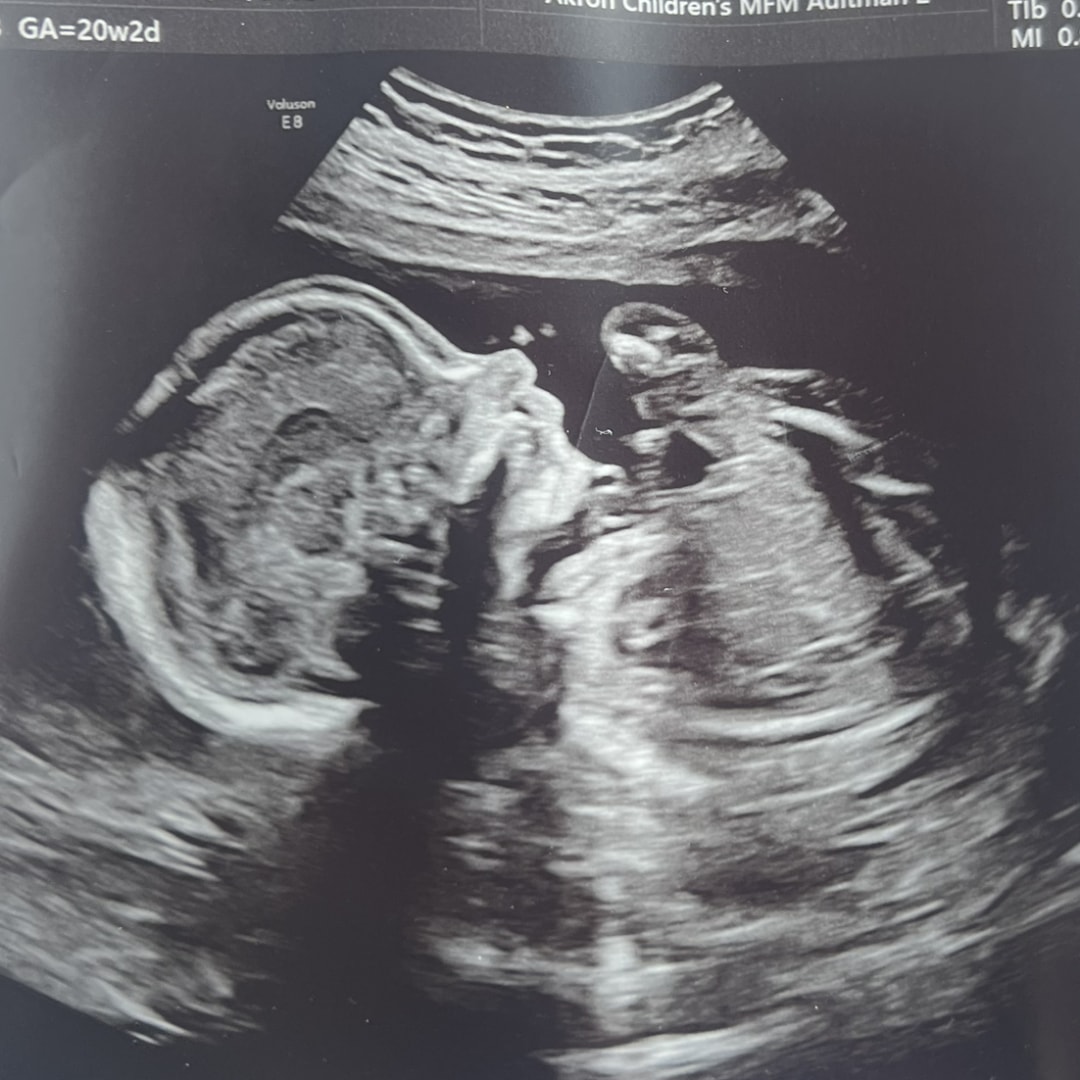 Photo shared by Makayla for their Babylist baby registry.