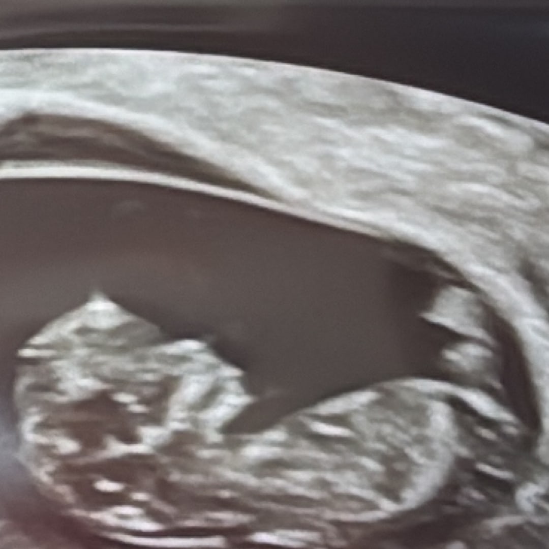 Photo shared by Rogee (Regi). for their Babylist baby registry.