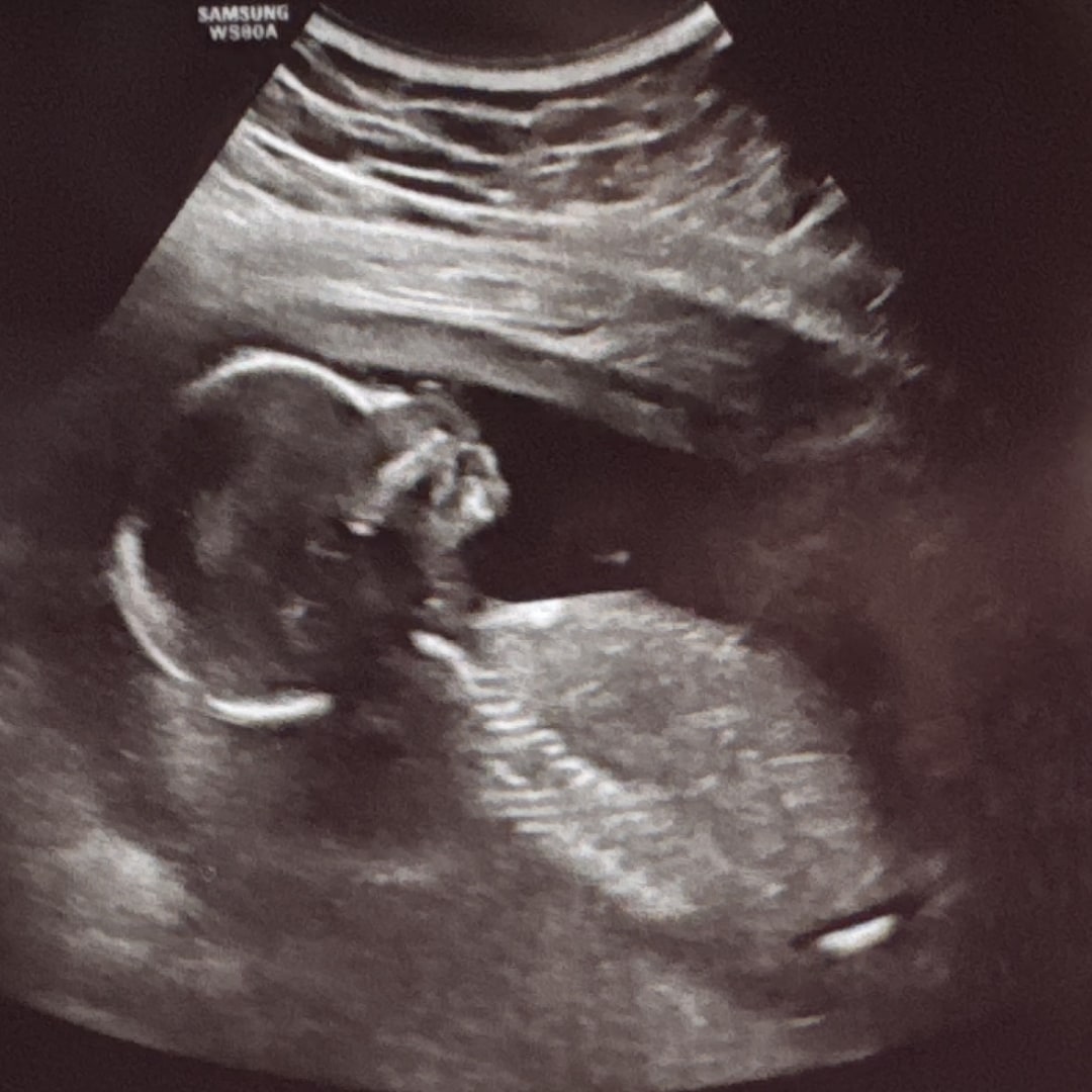 Photo shared by Christina for their Babylist baby registry.