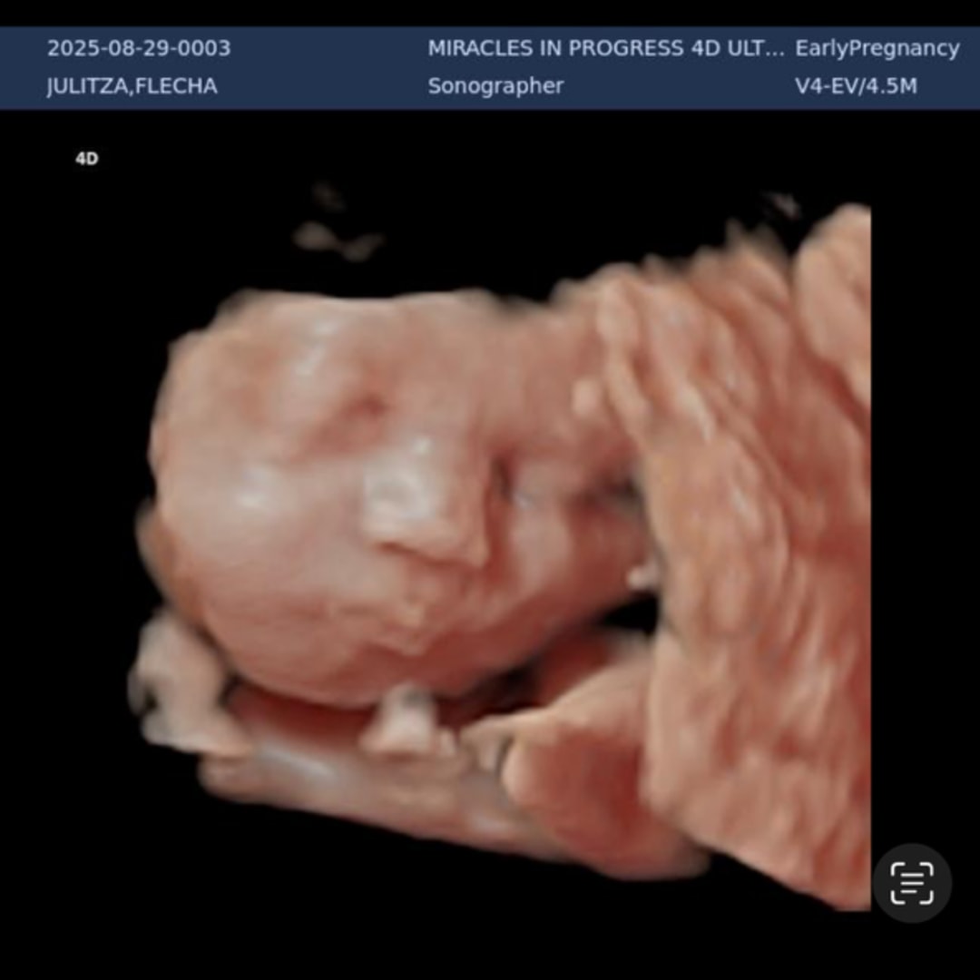 Photo shared by Julithza for their Babylist baby registry.