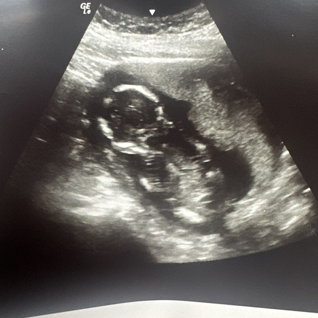 Photo shared by Brianna for their Babylist baby registry.