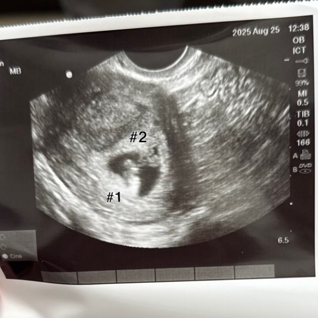 Photo shared by Clorinda for their Babylist baby registry.