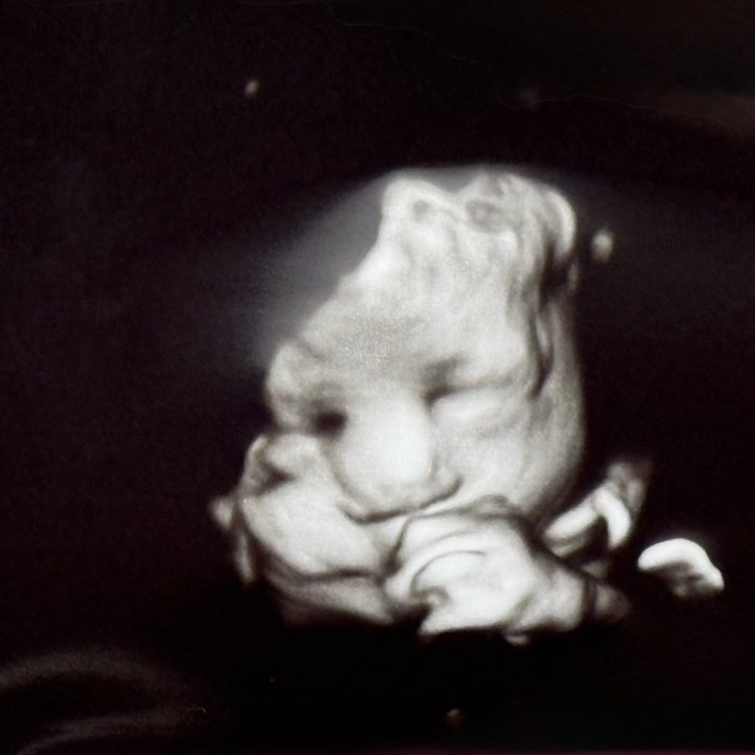 Photo shared by Lauren for their Babylist baby registry.