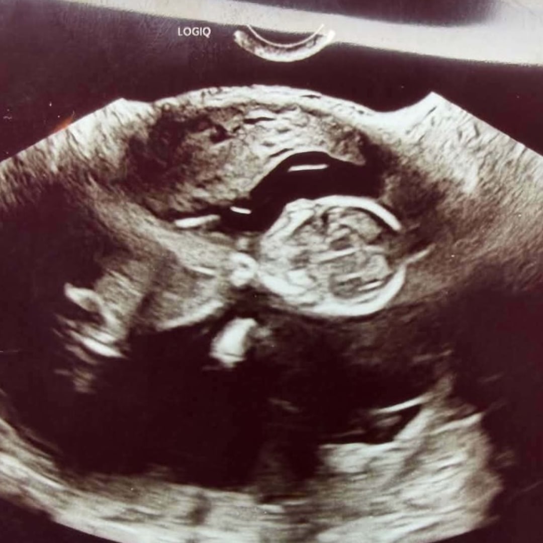 Photo shared by Cassandra for their Babylist baby registry.