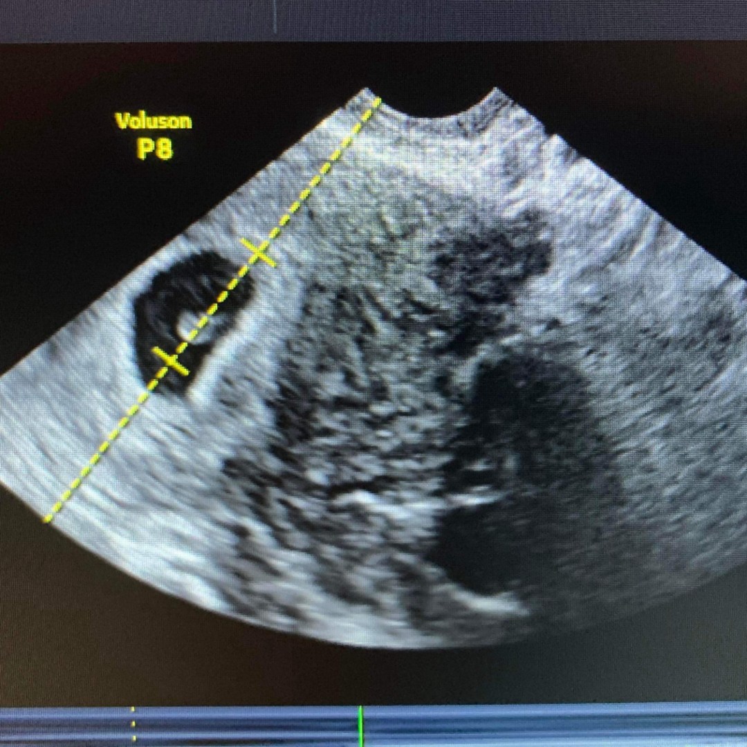 Photo shared by Beverly for their Babylist baby registry.