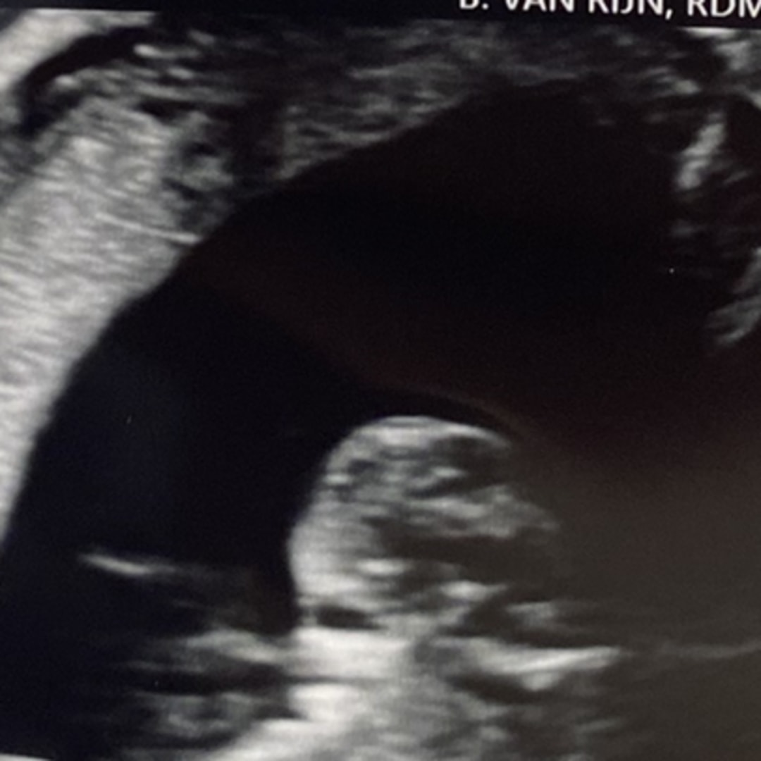 Photo shared by Keeghan for their Babylist baby registry.