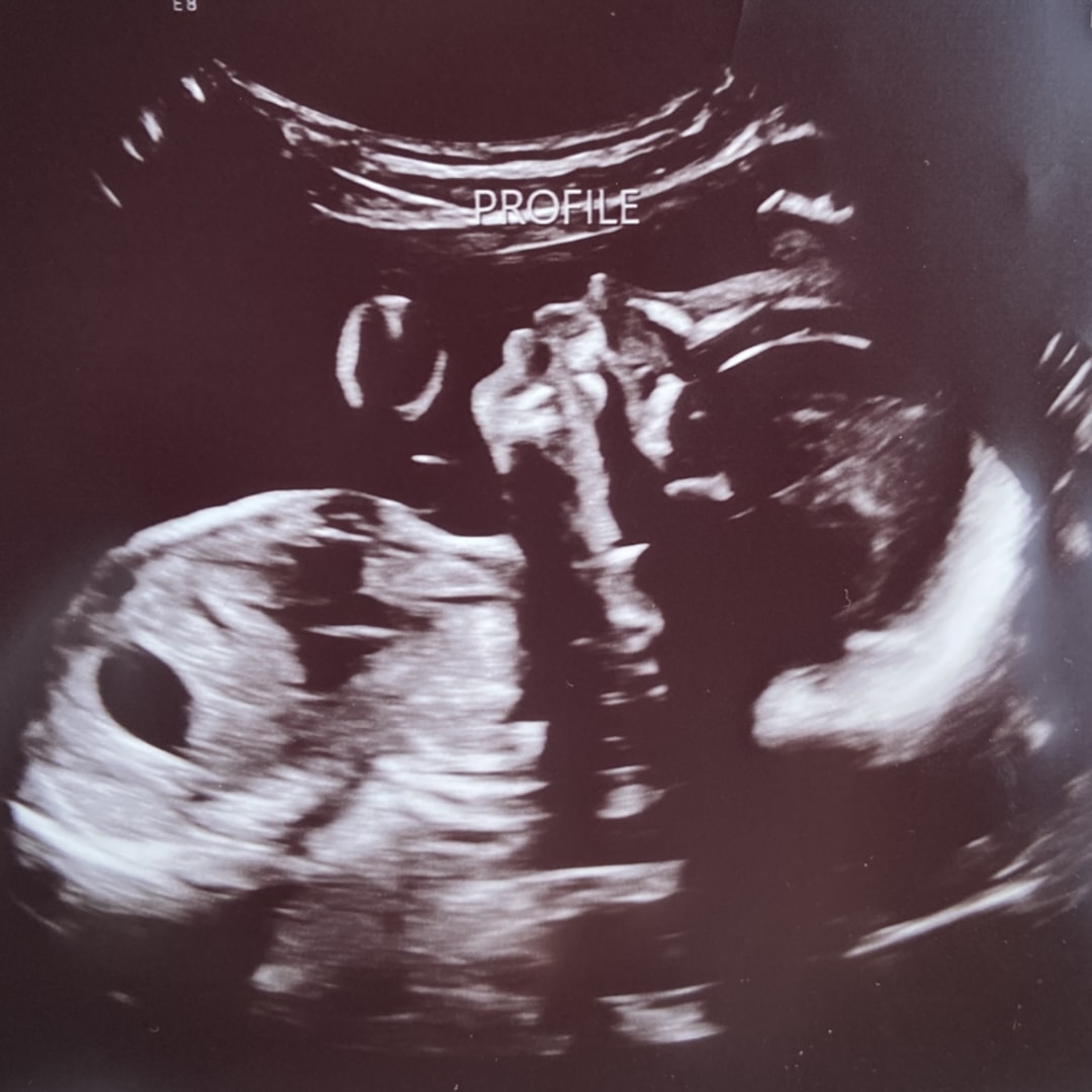 Photo shared by Cassidy for their Babylist baby registry.