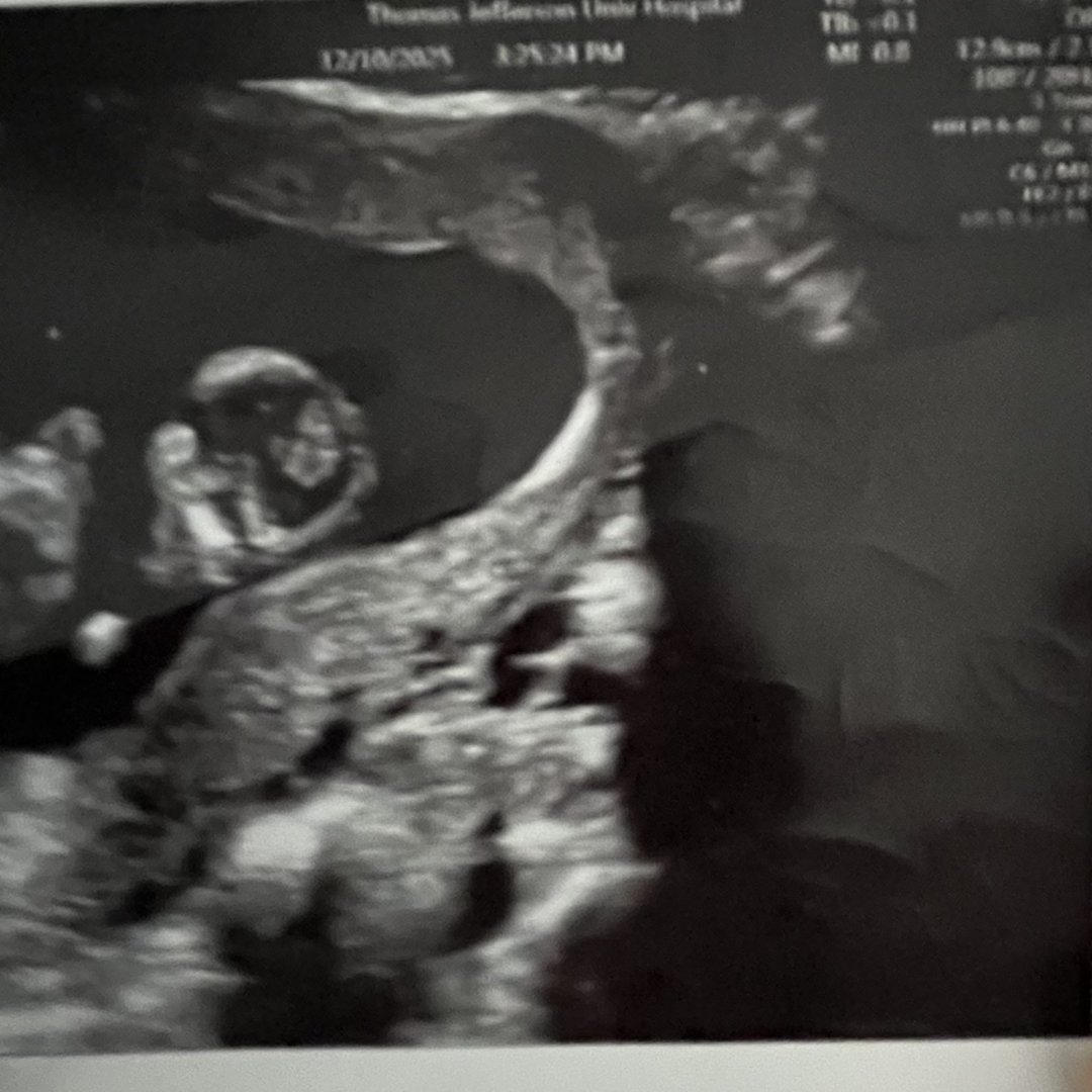 Photo shared by Safirah for their Babylist baby registry.