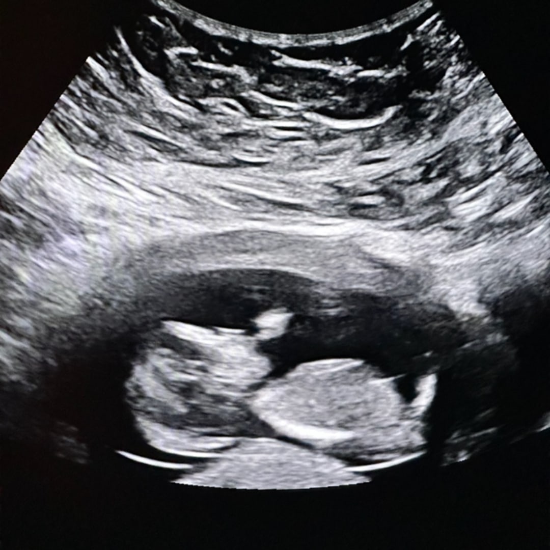 Photo shared by Ely for their Babylist baby registry.