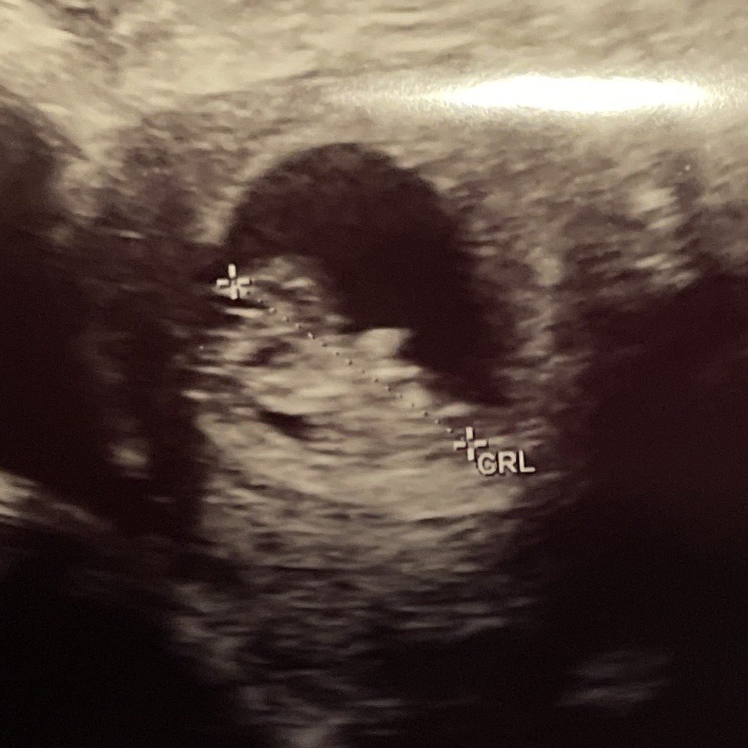 Photo shared by Kalee for their Babylist baby registry.