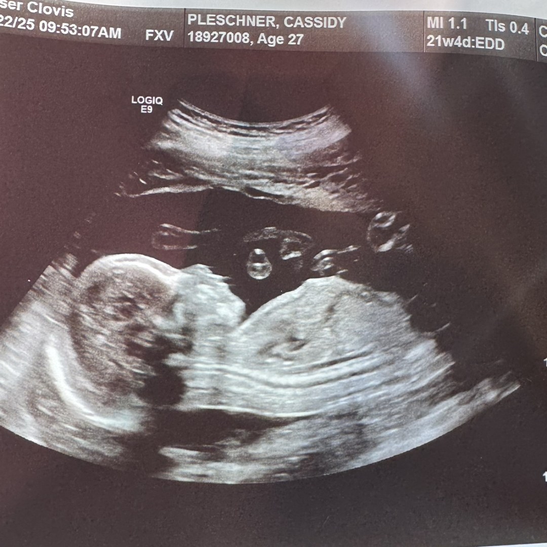 Photo shared by Cassidy for their Babylist baby registry.
