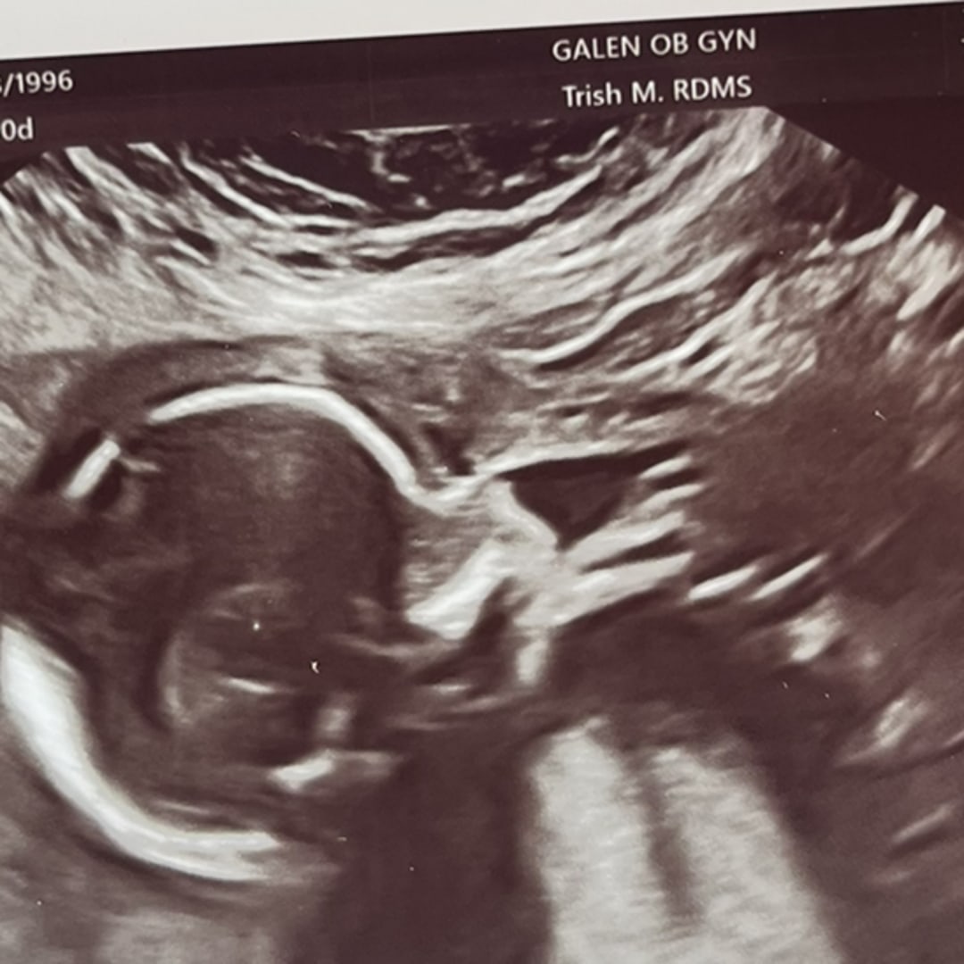 Photo shared by Mandalynn for their Babylist baby registry.