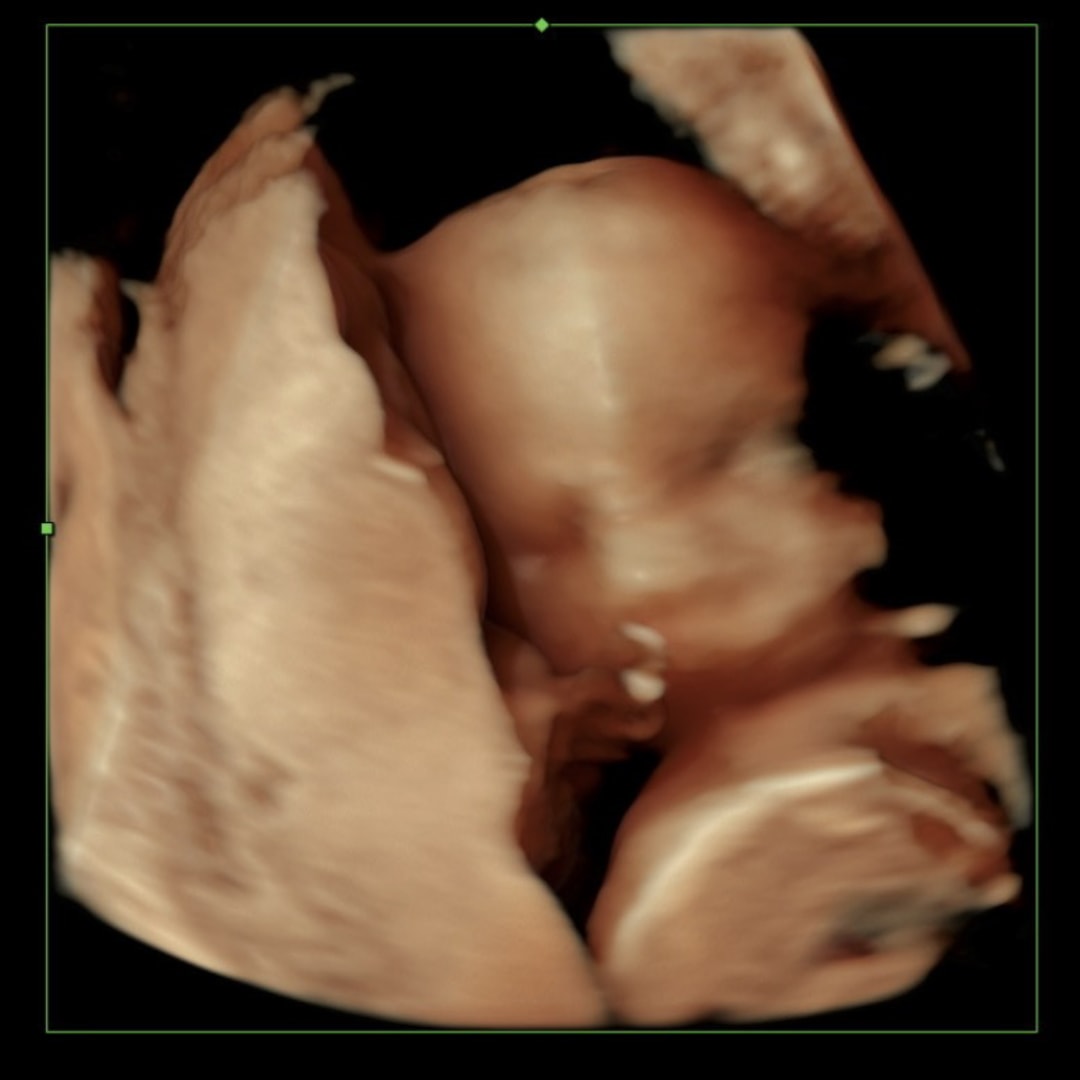 Photo shared by Morgan for their Babylist baby registry.