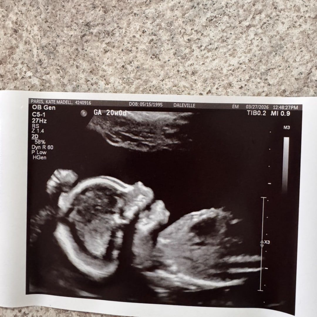 Photo shared by Kate for their Babylist baby registry.