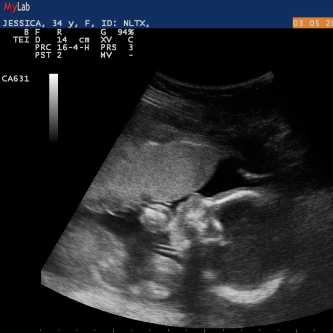 Photo shared by Jessica for their Babylist baby registry.