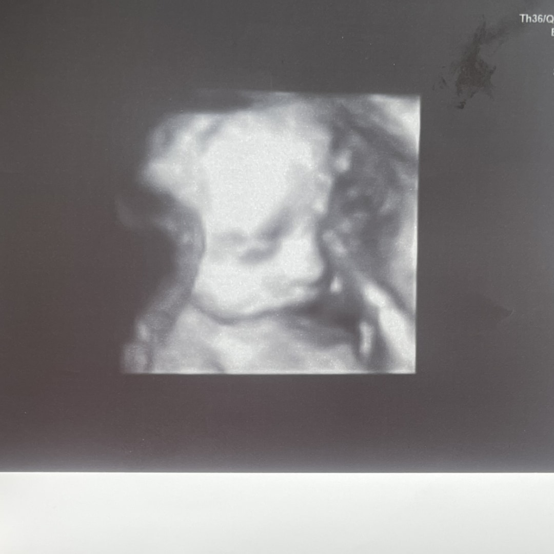 Photo shared by Susan for their Babylist baby registry.