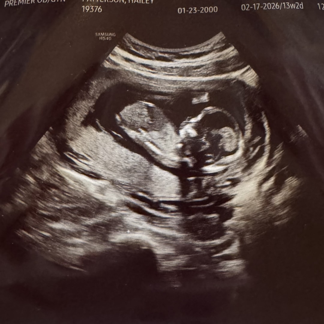 Photo shared by Hailey for their Babylist baby registry.