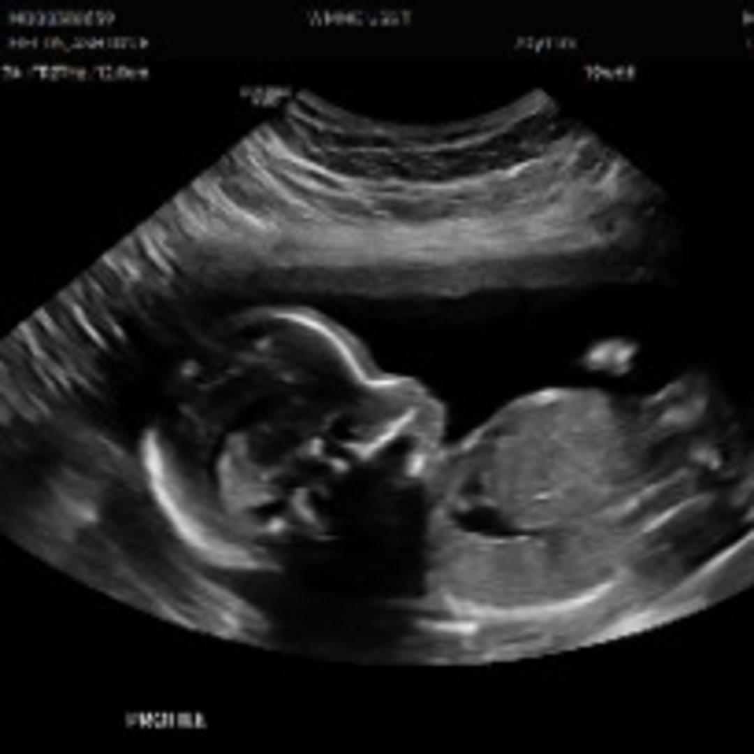 Photo shared by Cordelia for their Babylist baby registry.