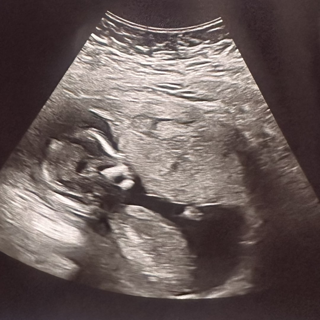 Photo shared by Aaron for their Babylist baby registry.