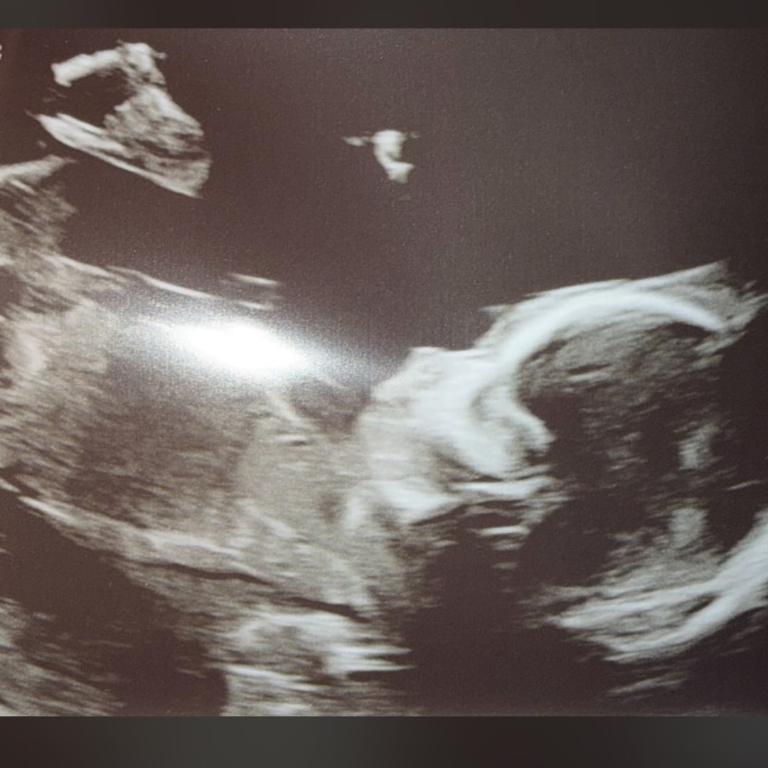 Photo shared by Emily for their Babylist baby registry.